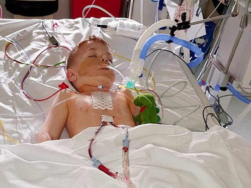 six year old son gets chest scar after life saving open heart surgery